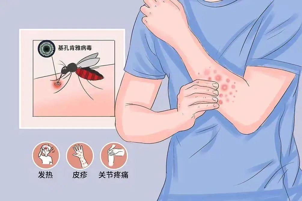 皇冠信用网登2代理
_风险增大皇冠信用网登2代理
!深圳疾控:去这247处要小心!张文宏首次发声